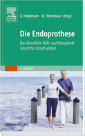 die_endoprothese